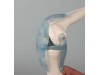 Knee Joint With Ligaments With Stand