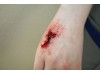 Ez Wounds Casualty Simulation Set Basic