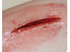 Ez Wounds Casualty Simulation Set Basic