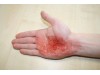 Ez Wounds Casualty Simulation Set Basic
